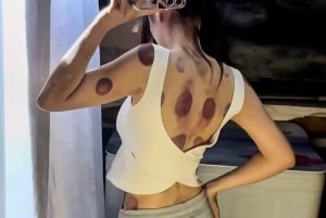 Beijing: Oplev magien og videnskaben bag kinesisk medicin