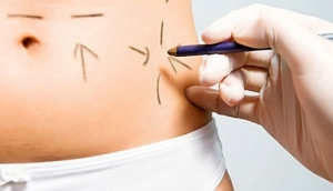 Cancun Plastic Surgery