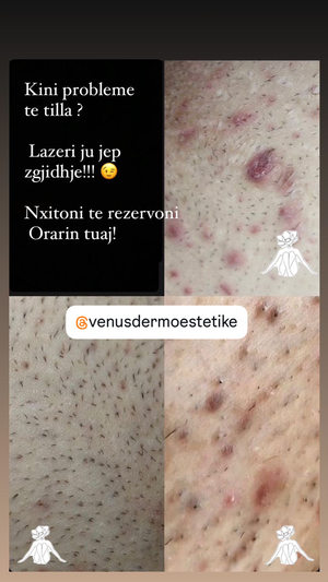 venusdermoestetike