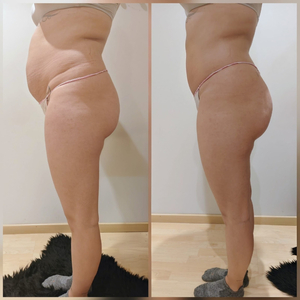 Corpolia, Clínica estética avanzada