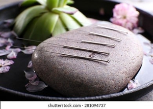 Cairns Acupuncture