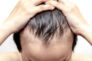 Best Hair Transplant Clinics in Korea: Maxwell Hair Clinic, Dream Hairline, Seojin Clinic & More!