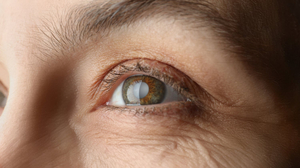 Cataract Surgery in Korea | Best Clinics, Costs, Procedure Types & more!