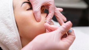 Thread Lift in Singapore | Costs, Best Clinics, Alternatives & More
