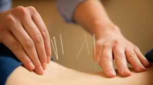 Shiva Naturopathy & Acupuncture Center