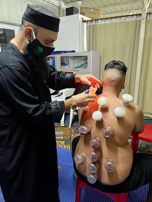Hijama Cupping FN Center