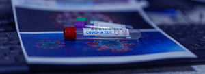 Covid тесты в Португалии, Алгарве. Где сделать тест? Сколько стоит тест?