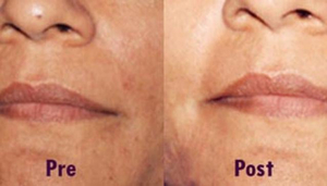 Laser Cure Cosmetic Laser Clinic
