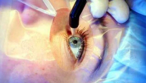 Shroff Eye