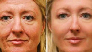 Skin N Sculpt