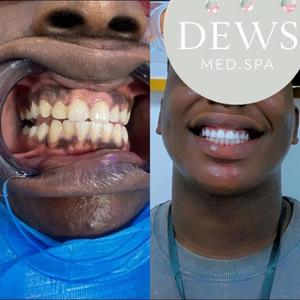 Dews Medspa & Aesthetics Clinic