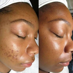 Tinted skin refine spa| luxury skincare & massage Awka