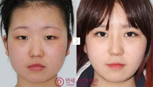 Yonsei J Plastic Surgery