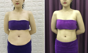 EvaCare Bình Dương - Giảm Mỡ Số 1 Bình Dương