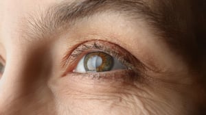 Kataraktoperation i Korea | Bästa klinikerna, kostnader, procedurtyper & mer!