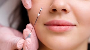 Nose Thread Lift in Korea | What Is Nose Thread Lifting? How Much Does It Cost? And Which Clinic? 