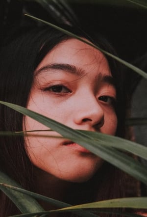 Revision Rhinoplasty In Seoul