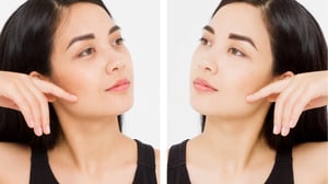 Under Eye Surgery in Korea | Costs, Best Clinics, Procedure Details & more!