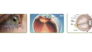 CEDS- El Centro de Diagnóstico y Cirugía Ocular