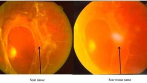 Drushti- Eye & Retina Centre & Rajvi Nursing Home