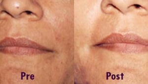 Laser Cure Cosmetic Laser Clinic