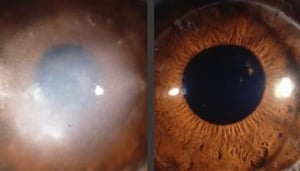 The Bhatti Eye Clinic