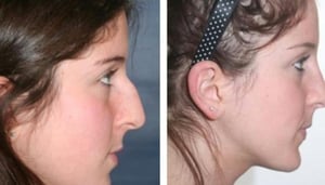 Centro de Cirugía Láser y Cosmética Vasudhan Arjin