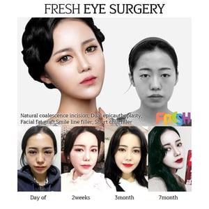 Fresh Plastic Surgery
