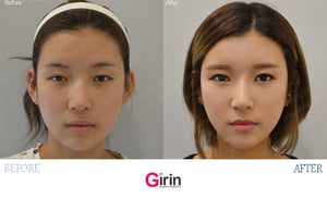 Girin Plastic Surgery