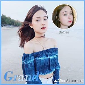 Grand Plastic Surgery