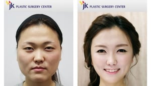 JK Plastic Surgery Center