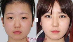 Yonsei J Plastic Surgery