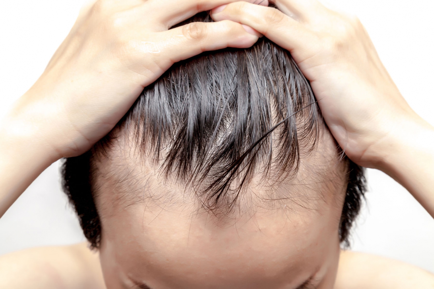 Top 10 hair transplant clinics in Mumbai - MouthShut.com