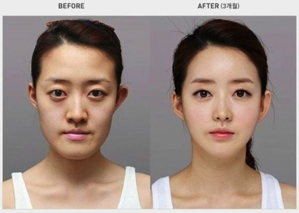 How to Find the Best Cosmetic Surgeon for You - Natural Looking Plastic  Surgery - DrJason Plastic Surgery