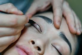 For upper and lower eyelid surgery in Korea, sufficient counseling and accurate diagnosis are needed