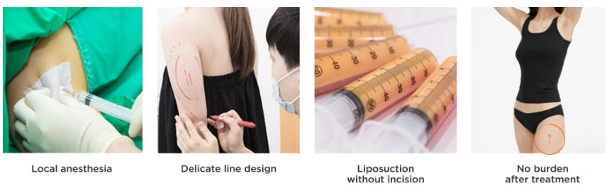 The Korean ‘fat dissolving injection’ revolutionizing liposuction 