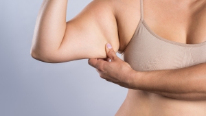 Arm Liposuction in Korea | Costs, Best Clinics and Types of Procedures