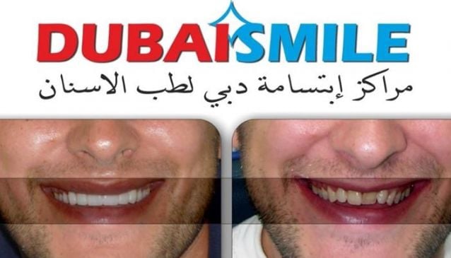 Dubai Smile Dental Center