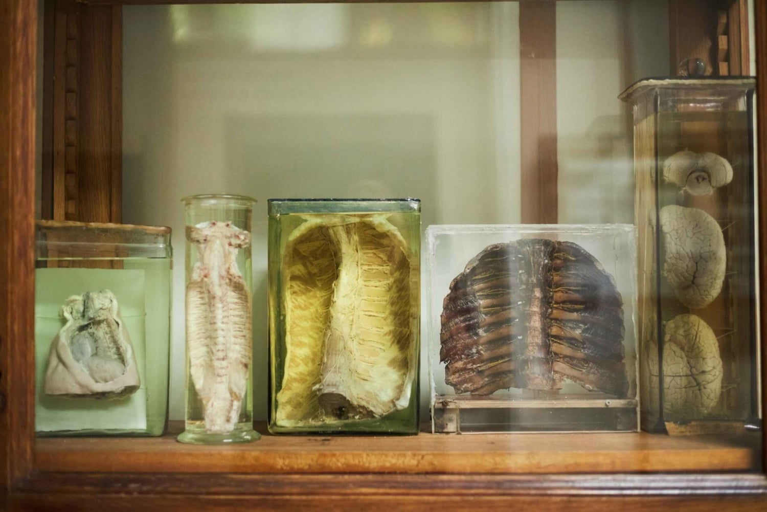 Surgeons' Hall Museums Private Guided Tour Edinburgh