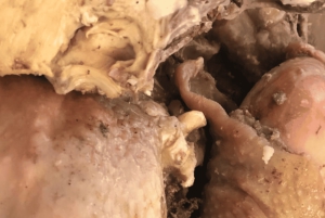 ヨハネスブルグ：ソウェト・タウンシップツアー（アフリカンフードツアー付き）