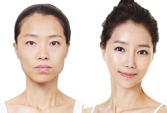 how to get plastic surgery in korea