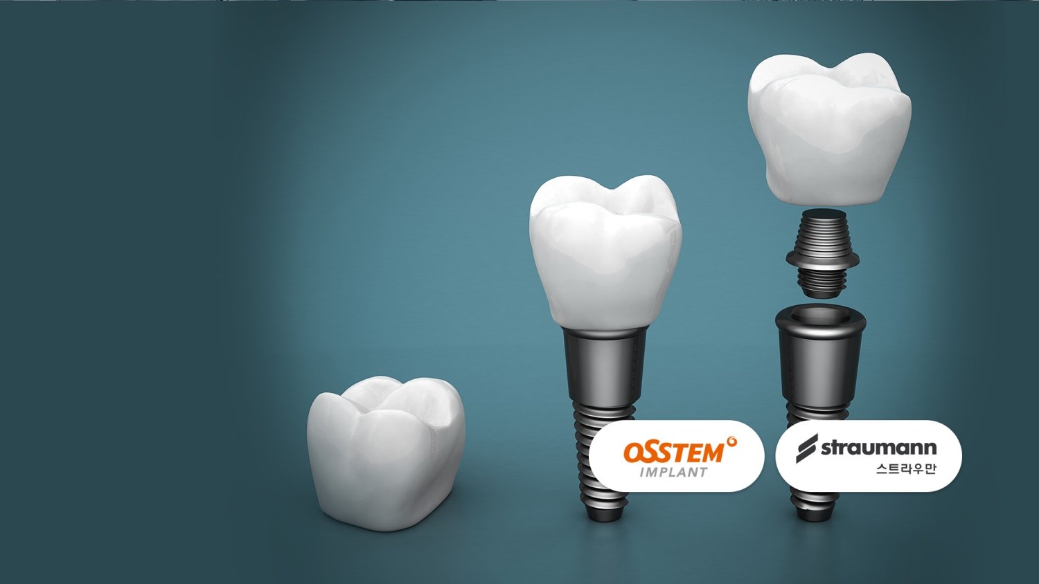 gentle-dental-implant