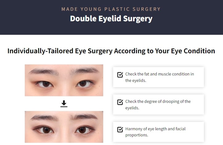 double eyelid surgery singapore cost