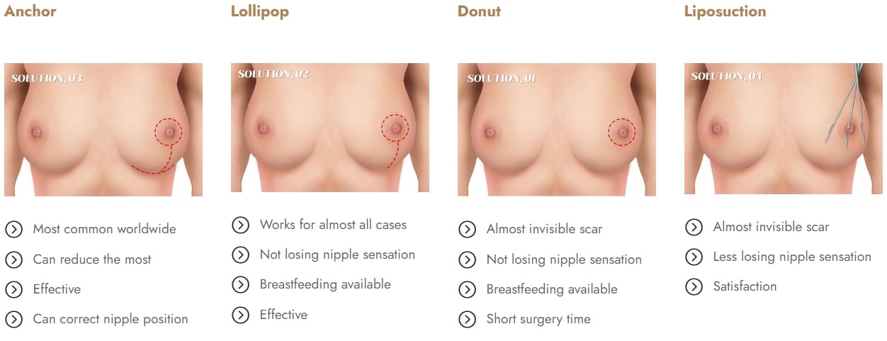 breast reduction surgery korea