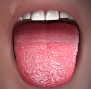 An image referencing the importance of understanding dry mouth according to a Korean dentist