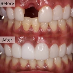 Biggest English Dental Hospital Seoul