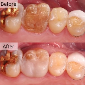 Biggest English Dental Hospital Seoul