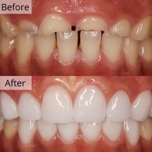 Biggest English Dental Hospital Seoul