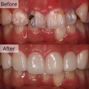 Biggest English Dental Hospital Seoul