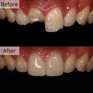 Biggest English Dental Hospital Seoul
